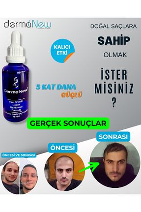 روغن و سرم مو dermanew hair - کد 794809368