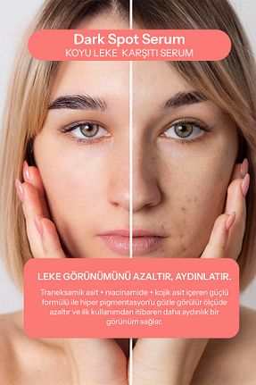 سرم پوست همه انواع پوست Heiluna - کد 921926619