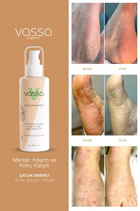 کرم پا Vassa - کد 834929468
