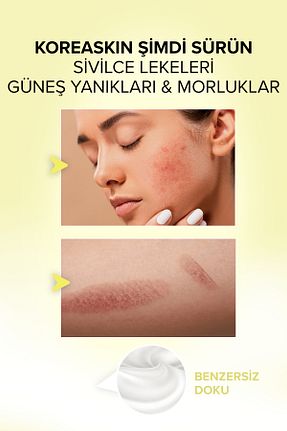 کرم صورت همه انواع پوست Acabella - کد 950536560
