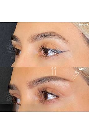 ست مراقبت پوست AKOLİFE - کد 362526395