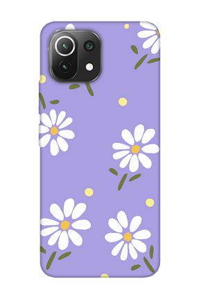 کاور و قاب بنفش frondcase - کد 711639910