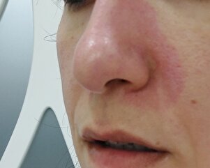 Müşteri yorumu görseli