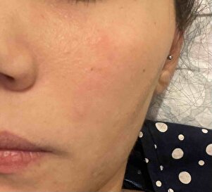 Müşteri yorumu görseli