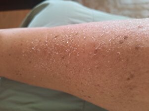 Değerlendirme fotoğrafı