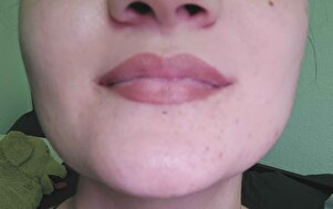 Müşteri yorumu görseli