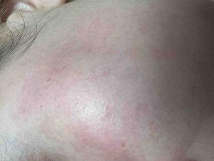 Müşteri yorumu görseli