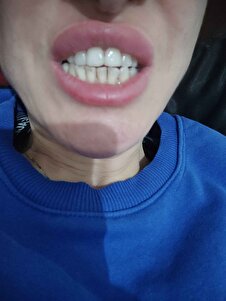 Müşteri yorumu görseli