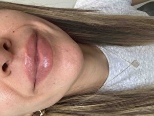 Müşteri yorumu görseli