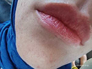 Müşteri yorumu görseli