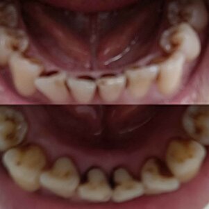 Müşteri yorumu görseli