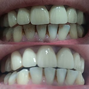 Müşteri yorumu görseli