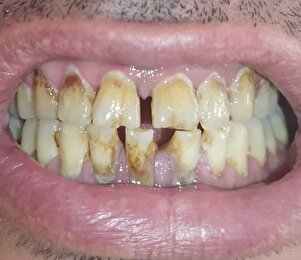 Müşteri yorumu görseli