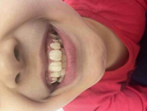 Müşteri yorumu görseli