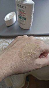 Müşteri yorumu görseli