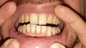 Müşteri yorumu görseli