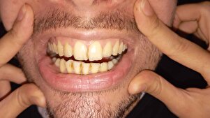 Müşteri yorumu görseli