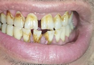 Müşteri yorumu görseli