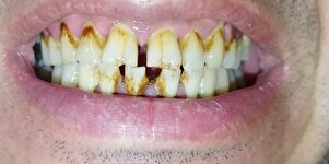 Müşteri yorumu görseli