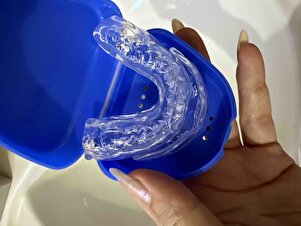 Müşteri yorumu görseli