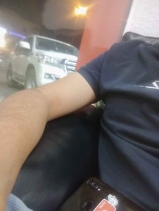 yorum görseli