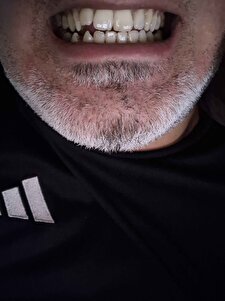 Müşteri yorumu görseli