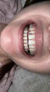 Müşteri yorumu görseli