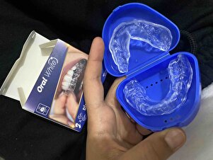 Müşteri yorumu görseli