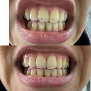 Müşteri yorumu görseli