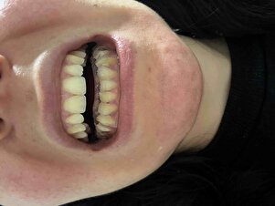 Müşteri yorumu görseli