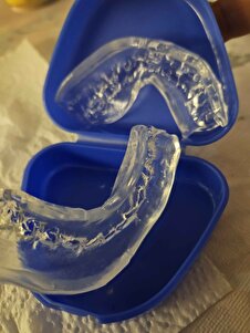 Müşteri yorumu görseli