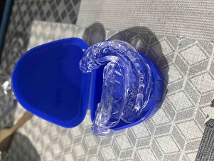 Müşteri yorumu görseli