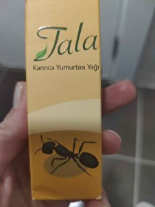 Müşteri yorumu görseli