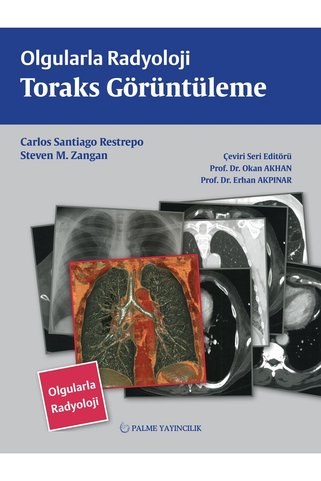 Palme Yayınevi Olgularla Radyoloji Toraks Görüntüleme
