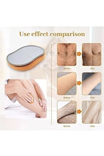 BEYZANA Crystal Eraser Epilasyon Aleti Tüy Silgisi Tüy Alıcı Fiziksel Kristal Epilatör