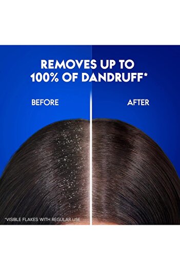 Head&Shoulders Head & Shoulders Dry Scalp Care Anti-Dandruff Shampoo With Almond Oil 400ml