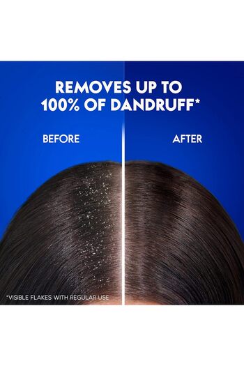 Head&Shoulders Head & Shoulders Daily Clean Anti-Dandruff Shampoo, 400 ml, Pack of 2
