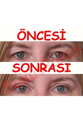 Generic 600 Adet Düşük Göz Kapağı Kaldırma Estetiği Bandı Kaldırıcı Bant Sticker Large Boy