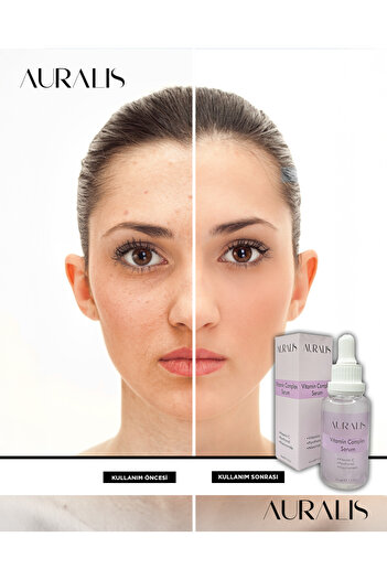Auralis Vitamin Complex Serum Onarıcı Parlaklık ve Leke Karşıtı Cilt Bakım Serumu 30 ml