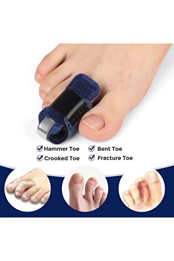 Choice Toe Straightener for Hammer Toe Corrector for Women Toe Brace Toe Splint Hammertoe Splint Toe Wra...