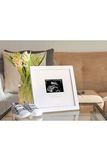 Pearhead Photo frame for storing ultrasound scans -