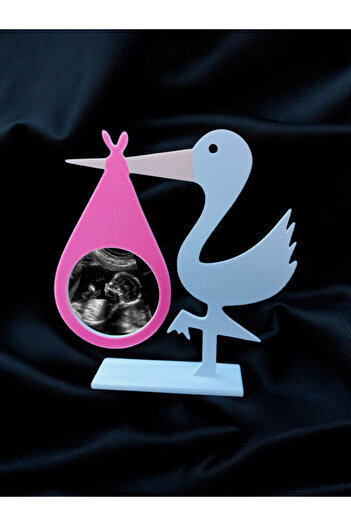 multiogz Ultrasound Frame & Leave a Beautiful Souvenir to Your Baby