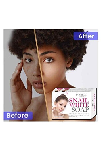 RousHun Snail White Soap 120g – Brightening, Repairing & Deep Cleansing Bar for Smooth Radiant Skin