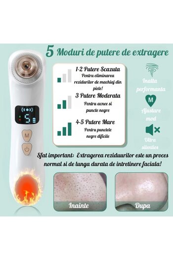 oemco Kalepo® Professional Blackhead Remover, Built-in HD Video Camera, Easy to Use