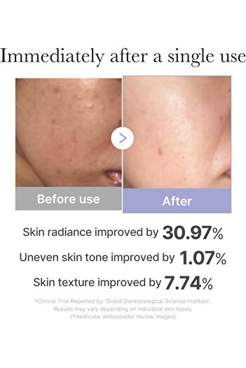 Medicube Mini Booster Pro Pink | Affordable At-Home Facial Skin Care Tool for Beginners - Portable G