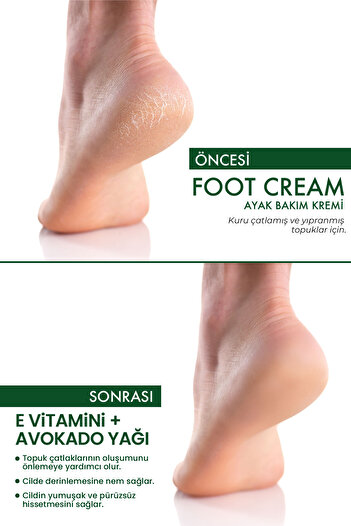 Picco De Luce MRS.UMRANTOO Crack Repair Cream Ayak Bakım Kremi 100 ml