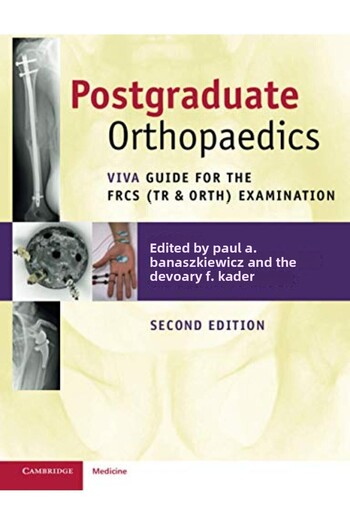Cambridge University Press Postgraduate Orthopaedics