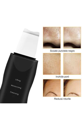 miraza Aparat de Curatare Faciala cu Ultrasunete, Skin Scrubber, Indepartare Puncte Negre, Anti Imbatranire