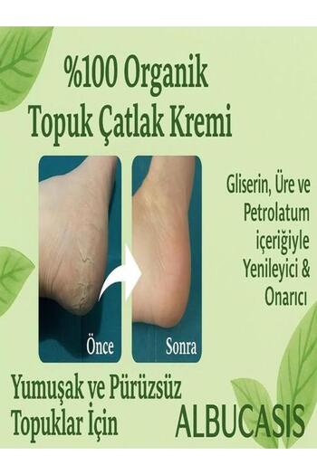 Albucasis Topuk Çatlak Kremi 100 ml.