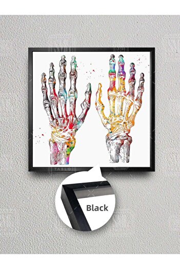 SML TABLO Fizioterapie Anatomia mâinii scheletul mâinii colorat Radiografie mâinii Fizioterapeut Pictură pe pânză pătrată înrămată